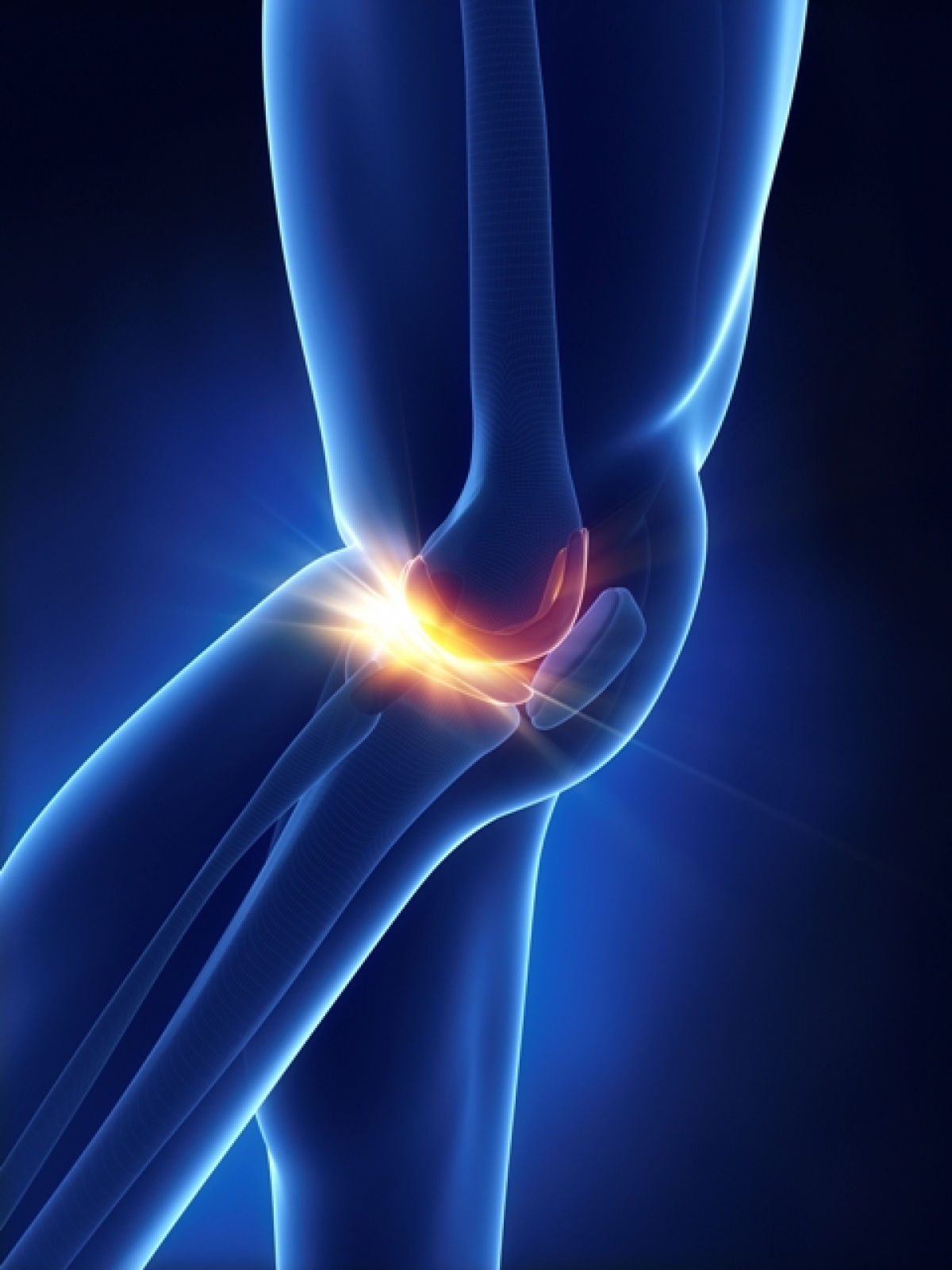 ΝΟΣΟΣ OSGOODSCHLATTER (ΟΣΤΕΟΧΟΝΔΡΙΤΙΔΑ ΤΟΥ ΚΝΗΜΙΑΙΟΥ ΚΥΡΤΩΜΑΤΟΣ